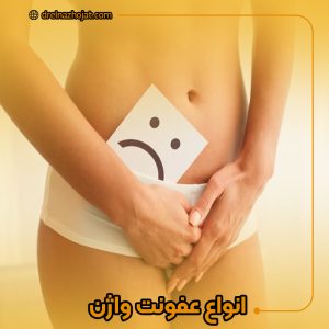 انواع عفونت واژن