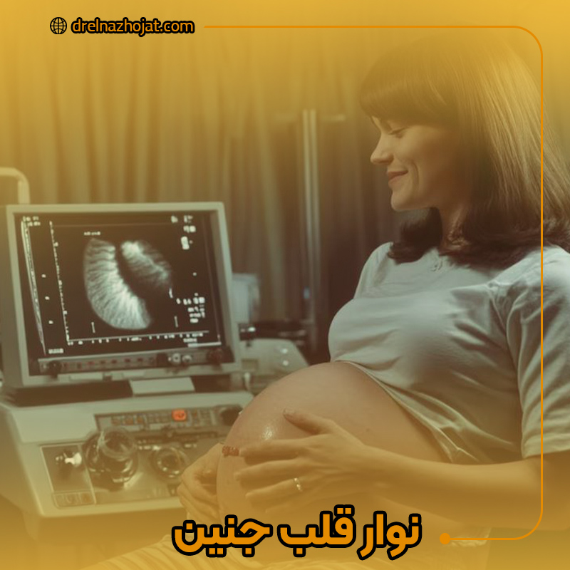 نوار قلب جنین
