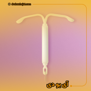 آی یو دی چیست؟