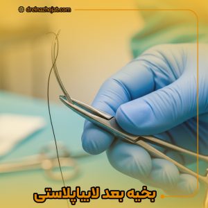 بخیه بعد از لابیاپلاستی